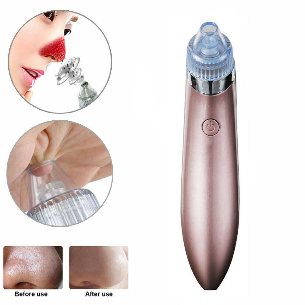 Electric Blackhead Vacuum Pore Cleaner Acne Pimple Remover Strong Suction Tool Electric Blackhead Remover Pore Vacuum Suction Diamond Dermabrasion Face Cleaner